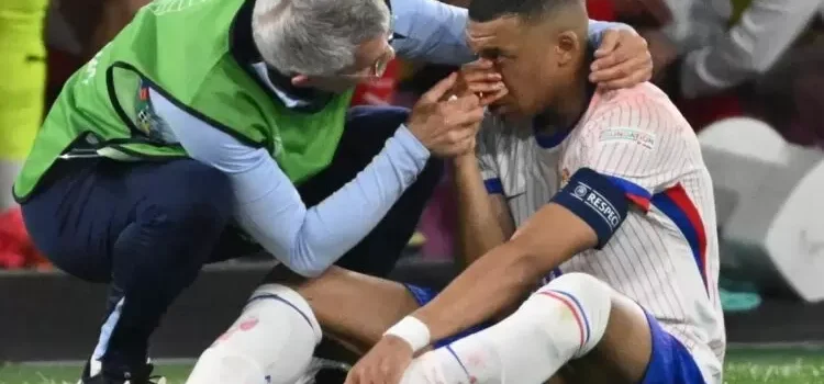 Mbappé, delantero del Real Madrid sufre fractura de nariz