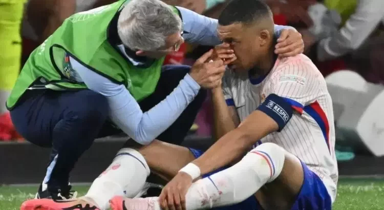 Mbappé, delantero del Real Madrid sufre fractura de nariz